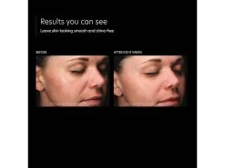 PCA SKIN HydraMatte Moisturizer 19 PCA SKIN HydraMatte Moisturizer -Beauty shop 35iilovm 202205261505423158