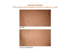 Dr. Dennis Gross Skincare Alpha Beta Exfoliating Body Treatment -Beauty shop arbiwclu 202102011630075152