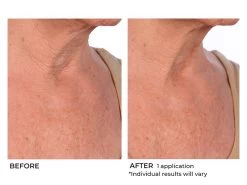 NassifMD® Hydro-Screen Intense Hydration Face & Body Soufflé -Beauty shop aw41iycr 202009231652049359