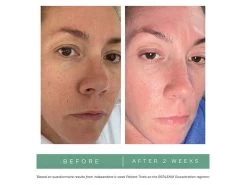 Replenix Pigment Correcting Brightening Cream -Beauty shop byo50slc 202208101823260838