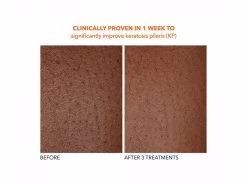 Dr. Dennis Gross Skincare Alpha Beta Exfoliating Body Treatment -Beauty shop dggpqcrx 202102011547304478