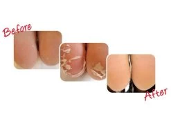 Baby Foot Exfoliation Foot Peel For Men -Beauty shop dpjm4rri 201905061255247244