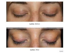 NeuLASH PROFESSIONAL™ Lash Enhancing Serum By Skin Research Laboratories® -Beauty shop dwofgfju 202004082224036235