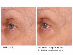 NassifMD® Age-Defying Eye Renewal Serum -Beauty shop f05kk3fy 202202211733148416