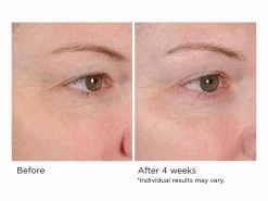 NassifMD® Peri-Orbital Complex Revitalizing Eye Cremè 9 NassifMD® Peri-Orbital Complex Revitalizing Eye Cremè -Beauty shop f1g2los0 202009231754082984