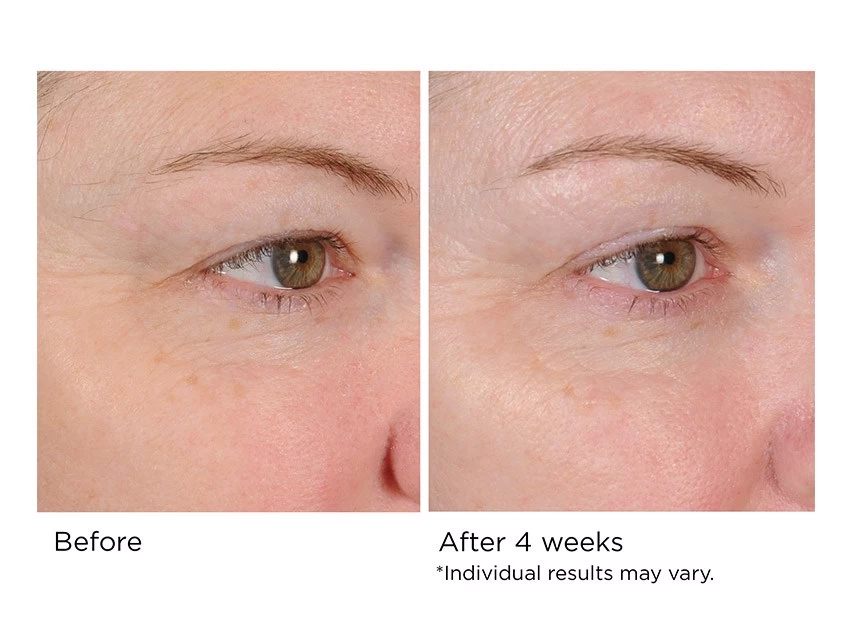 NassifMD® Peri-Orbital Complex Revitalizing Eye Cremè 6 NassifMD® Peri-Orbital Complex Revitalizing Eye Cremè - Image 4