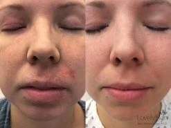 FixMySkin 1% Hydrocortisone Healing Body Balm – Fragrance-Free -Beauty shop fij330lu 202004281850336751