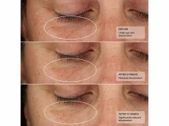 Senté Illuminé Eye Cream -Beauty shop gdirzzlo 202305051523449238