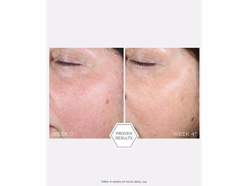 NEOSTRATA Restore PHA Renewal Pads 7 NEOSTRATA Restore PHA Renewal Pads - Image 5