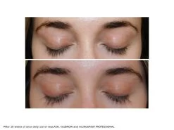 NeuLASH & NeuBROW PROFESSIONAL Eyelash & Eyebrow Enhancing Serum Duo -Beauty shop jlwplu0c 202305171822091280