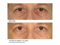 NassifMD® Anti-Aging Under Eye Smoother -Beauty shop ov1yyog2 202009231839498383