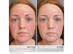 Jane Iredale HydroPure Color Correcting Serum With Hyaluronic Acid & CoQ10 -Beauty shop ovf1j1c0 202306271619282676