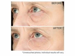 StriVectin Hyperlift Eye Instant Eye Fix -Beauty shop t3kbpwfb 202106302123357152