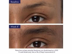 Obagi Nu-Cil™ Eyebrow Boosting Serum -Beauty shop tuh5rbfq 202208171949194865