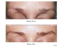 NeuLASH/neuBROW PROFESSIONAL™ By Skin Research Laboratories® Introductory Kit -Beauty shop tzf0fvka 202004082232240799