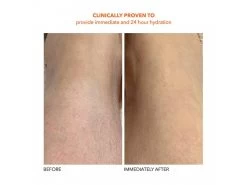 Dr. Dennis Gross Skincare Alpha Beta Exfoliating Body Treatment -Beauty shop ucknz31g 202102011634508655