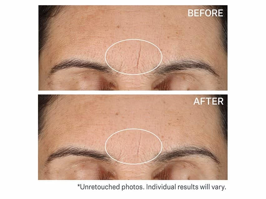 StriVectin Line BlurFector Instant Wrinkle Blurring Primer 4 StriVectin Line BlurFector Instant Wrinkle Blurring Primer - Image 2