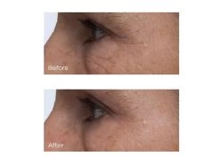 Perricone MD Cold Plasma Plus+ Eye Advanced Eye Cream 9 Perricone MD Cold Plasma Plus+ Eye Advanced Eye Cream -Beauty shop xavjxpcu 202002271626273975