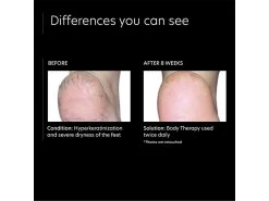 PCA SKIN Body Therapy 14 PCA SKIN Body Therapy -Beauty shop xyeeu4od 202205241517485182