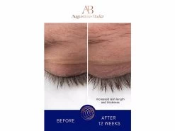 Augustinus Bader The Eyebrow & Lash Enhancing Serum -Beauty shop xzcvb1ul 202302201334114474