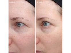 Colorescience Total Eye Firm & Repair Cream -Beauty shop y1aisv1i 202110141753275586