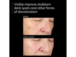 PCA SKIN Pigment Gel Pro -Beauty shop zs5lsilp 202303141600336807